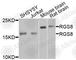 Regulator Of G Protein Signaling 8 antibody, A9987, ABclonal Technology, Western Blot image 