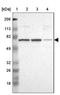 Angiomotin Like 1 antibody, NBP1-91665, Novus Biologicals, Western Blot image 