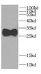 Carbonic Anhydrase 7 antibody, FNab01165, FineTest, Western Blot image 