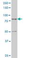 Forkhead box protein E1 antibody, H00008458-M12, Novus Biologicals, Western Blot image 