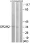 Olfactory Receptor Family 2 Subfamily M Member 2 antibody, A17539, Boster Biological Technology, Western Blot image 
