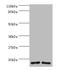 Ribosomal Protein S16 antibody, A52696-100, Epigentek, Western Blot image 