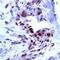 Fms Related Tyrosine Kinase 1 antibody, PA1-37710, Invitrogen Antibodies, Immunohistochemistry paraffin image 
