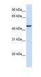 Lysine Demethylase 6A antibody, orb324797, Biorbyt, Western Blot image 