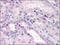 CCAAT Enhancer Binding Protein Beta antibody, AM06039PU-N, Origene, Immunohistochemistry paraffin image 