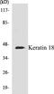 Keratin 18 antibody, EKC1324, Boster Biological Technology, Western Blot image 