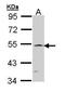 RBPJK antibody, PA5-22226, Invitrogen Antibodies, Western Blot image 