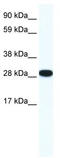 ZFP36 Ring Finger Protein Like 1 antibody, TA333955, Origene, Western Blot image 