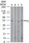 Protein Inhibitor Of Activated STAT 4 antibody, PA1-29456, Invitrogen Antibodies, Western Blot image 
