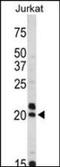 VIP peptides antibody, orb89018, Biorbyt, Western Blot image 