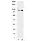 Selectin E antibody, R30793, NSJ Bioreagents, Western Blot image 