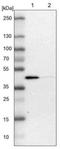 Acyl-CoA Dehydrogenase Long Chain antibody, NBP1-89289, Novus Biologicals, Western Blot image 