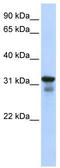 Lysosomal Protein Transmembrane 4 Beta antibody, TA342374, Origene, Western Blot image 