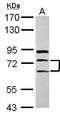 EEF1A Lysine And N-Terminal Methyltransferase antibody, GTX120626, GeneTex, Western Blot image 