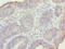 Meiotic Nuclear Divisions 1 antibody, LS-C398396, Lifespan Biosciences, Immunohistochemistry paraffin image 