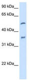 Cytochrome P450 Family 2 Subfamily D Member 6 antibody, TA346157, Origene, Western Blot image 