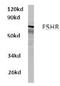 Follicle Stimulating Hormone Receptor antibody, AP01215PU-N, Origene, Western Blot image 