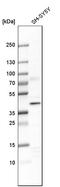 DDB1- and CUL4-associated factor 7 antibody, HPA022948, Atlas Antibodies, Western Blot image 