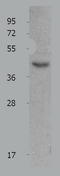 Melanocortin 5 Receptor antibody, TA322541, Origene, Western Blot image 
