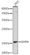 Somatoliberin antibody, GTX54141, GeneTex, Western Blot image 