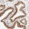 Zinc Finger Protein 782 antibody, HPA011013, Atlas Antibodies, Immunohistochemistry paraffin image 