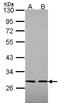 Sarcolemma Associated Protein antibody, LS-C186375, Lifespan Biosciences, Western Blot image 