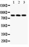 Serine/threonine-protein phosphatase 2B catalytic subunit alpha isoform antibody, LS-C357573, Lifespan Biosciences, Western Blot image 