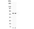 E2F Transcription Factor 3 antibody, R31261, NSJ Bioreagents, Western Blot image 