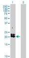 Platelet-derived growth factor subunit A antibody, H00005154-D01P, Novus Biologicals, Western Blot image 