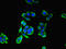 Centrosomal protein of 83 kDa antibody, LS-C675510, Lifespan Biosciences, Immunofluorescence image 