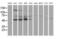 Protein Phosphatase, Mg2+/Mn2+ Dependent 1G antibody, MA5-25372, Invitrogen Antibodies, Western Blot image 