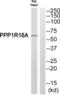 Protein Phosphatase 1 Regulatory Subunit 16A antibody, abx014747, Abbexa, Western Blot image 