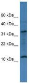 Chromosome 14 Open Reading Frame 177 antibody, TA333395, Origene, Western Blot image 