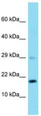 40S ribosomal protein S23 antibody, TA337937, Origene, Western Blot image 