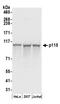 Rho GTPase Activating Protein 4 antibody, A304-513A, Bethyl Labs, Western Blot image 