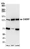 Calcium Homeostasis Endoplasmic Reticulum Protein antibody, A304-621A, Bethyl Labs, Western Blot image 