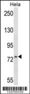 Moesin antibody, 57-245, ProSci, Western Blot image 
