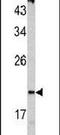 pVHL antibody, PA5-13488, Invitrogen Antibodies, Western Blot image 