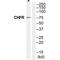 Checkpoint With Forkhead And Ring Finger Domains antibody, PA5-50177, Invitrogen Antibodies, Western Blot image 