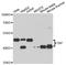 TATA-Box Binding Protein antibody, A10185, ABclonal Technology, Western Blot image 