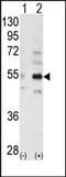 STE20 Related Adaptor Beta antibody, AP13724PU-N, Origene, Western Blot image 