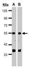 G Protein Pathway Suppressor 1 antibody, PA5-27149, Invitrogen Antibodies, Western Blot image 