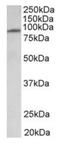Major Facilitator Superfamily Domain Containing 6 antibody, orb12383, Biorbyt, Western Blot image 