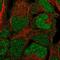 BRCA2 and CDKN1A-interacting protein antibody, HPA038011, Atlas Antibodies, Immunofluorescence image 