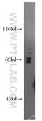 PIF1 5'-To-3' DNA Helicase antibody, 19006-1-AP, Proteintech Group, Western Blot image 