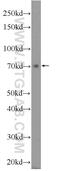 Zinc Finger Protein 460 antibody, 25299-1-AP, Proteintech Group, Western Blot image 