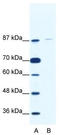 TATA-Box Binding Protein Associated Factor, RNA Polymerase I Subunit C antibody, TA343556, Origene, Western Blot image 