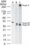 Reticulon 4 antibody, TA336446, Origene, Western Blot image 