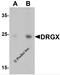 Dorsal root ganglia homeobox protein antibody, 6517, ProSci, Western Blot image 
