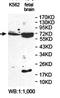 Plastin 3 antibody, orb78328, Biorbyt, Western Blot image 
